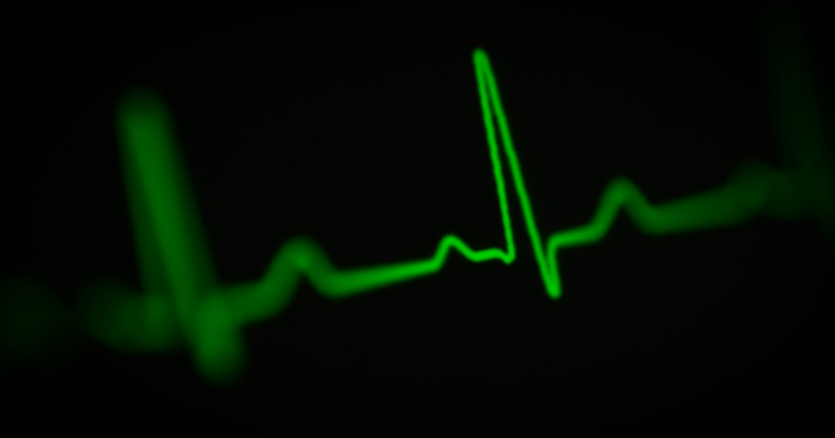 Línea de pulso verde sobre fondo negro